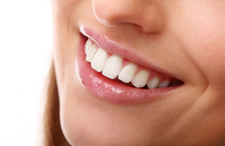 Rifacimento del sorriso